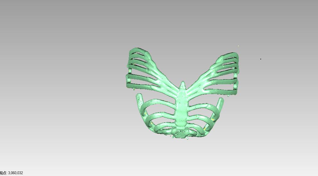 三維掃描儀在醫(yī)療領(lǐng)域的解決方案 三維掃描儀在醫(yī)療領(lǐng)域的解決方案